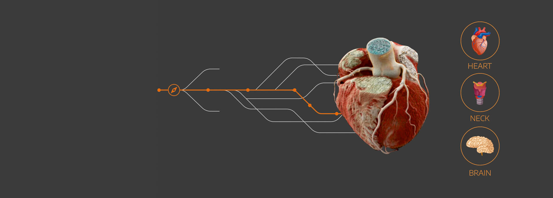 heart-angiography